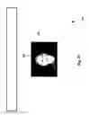 Fig. 68 - Neuroplasticity games for depression