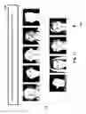 Fig. 72 - Neuroplasticity games for depression
