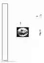 Fig. 74 - Neuroplasticity games for depression