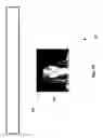 Fig. 80 - Neuroplasticity games for depression