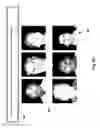 Fig. 84 - Neuroplasticity games for depression