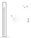 Fig. 85 - Neuroplasticity games for depression