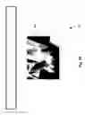 Fig. 86 - Neuroplasticity games for depression