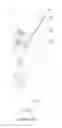 Fig. 04 - Ground fault circuit interrupter
