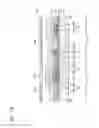 Fig. 10 - Transparent organic light-emitting diode display with capacitor overlapping light transmitting region