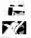Fig. 10 - Cross-woven electrode assembly