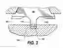 Fig. 04 - Soldered interconnect for a printed circuit board having an angular radial feature