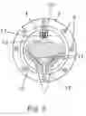 Fig. 04 - System and method for storing high capacity electric energy