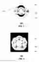 Fig. 03 - Repeater and methods for use therewith
