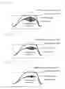 Fig. 16 - Imaging sensor and imaging device