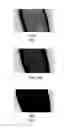 Fig. 06 - Biochemistry measurement device and method thereof