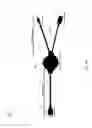 Fig. 20 - Binaural recording system and earpiece set