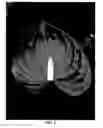Fig. 03 - Anthurium plant named 'ANTHDASYM'