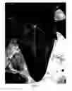Fig. 04 - Anthurium plant named 'ANTHDASYM'