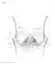 Fig. 09 - Brassiere