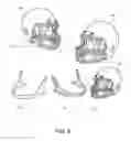 Fig. 07 - Head restraint system having a rate sensitive device