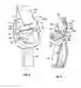 Fig. 06 - Buckle for exercise strap