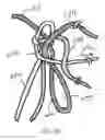 Fig. 10 - METHOD AND APPARATUS FOR AN ADJUSTABLE HARNESS