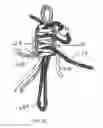 Fig. 15 - METHOD AND APPARATUS FOR AN ADJUSTABLE HARNESS