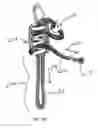 Fig. 17 - METHOD AND APPARATUS FOR AN ADJUSTABLE HARNESS