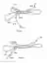 Fig. 24 - METHOD AND APPARATUS FOR AN ADJUSTABLE HARNESS