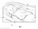 Fig. 02 - Bath cover for child