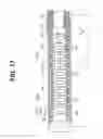 Fig. 16 - ENDOSCOPE