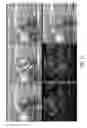 Fig. 14 - Optoacoustic probe with multi-layer coating