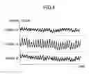 Fig. 05 - PULSE WAVE MEASURING DEVICE, SYSTEM, AND METHOD