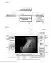 Fig. 02 - METHOD FOR MEASURING SIZE OF LESION WHICH IS SHOWN BY ENDOSCOPE, AND COMPUTER READABLE RECORDING MEDIUM