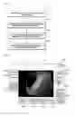 Fig. 03 - METHOD FOR MEASURING SIZE OF LESION WHICH IS SHOWN BY ENDOSCOPE, AND COMPUTER READABLE RECORDING MEDIUM