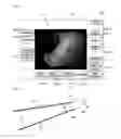 Fig. 04 - METHOD FOR MEASURING SIZE OF LESION WHICH IS SHOWN BY ENDOSCOPE, AND COMPUTER READABLE RECORDING MEDIUM