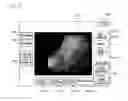 Fig. 06 - METHOD FOR MEASURING SIZE OF LESION WHICH IS SHOWN BY ENDOSCOPE, AND COMPUTER READABLE RECORDING MEDIUM