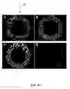 Fig. 55 - METHOD AND SYSTEM FOR QUANTITATIVE ASSESSMENT OF VISUAL MOTOR RESPONSE