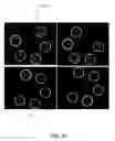 Fig. 57 - METHOD AND SYSTEM FOR QUANTITATIVE ASSESSMENT OF VISUAL MOTOR RESPONSE