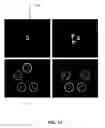 Fig. 63 - METHOD AND SYSTEM FOR QUANTITATIVE ASSESSMENT OF VISUAL MOTOR RESPONSE