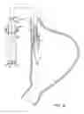 Fig. 14 - Methods and devices for manipulating and fastening tissue