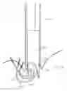 Fig. 35 - Methods and devices for manipulating and fastening tissue