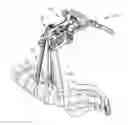 Fig. 01 - Spinal access retractor
