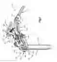 Fig. 04 - Spinal access retractor