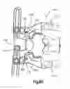 Fig. 44 - Spinal access retractor