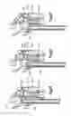 Fig. 65 - Spinal access retractor
