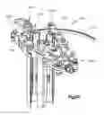 Fig. 69 - Spinal access retractor