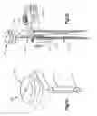 Fig. 83 - Spinal access retractor