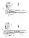 Fig. 84 - Spinal access retractor