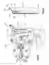 Fig. 92 - Spinal access retractor
