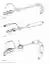 Fig. 04 - INFLATABLE LAPAROSCOPIC RETRACTOR FOR ATRAUMATIC RETRACTION IN ABDOMINAL SURGERY