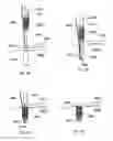 Fig. 32 - Implant placement systems, devices and methods