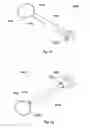 Fig. 49 - Implant placement systems, devices and methods