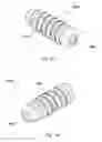Fig. 52 - Implant placement systems, devices and methods